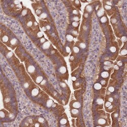 NT5DC2 Antibody, Novus Biologicals:Antibodies:Primary Antibodies